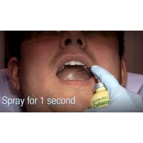 Cetacaine® Topical Anesthetic Spray