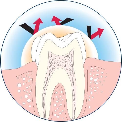 Zarosen Desensitizing Cavity Varnish and Dentinal Tubuli Seal